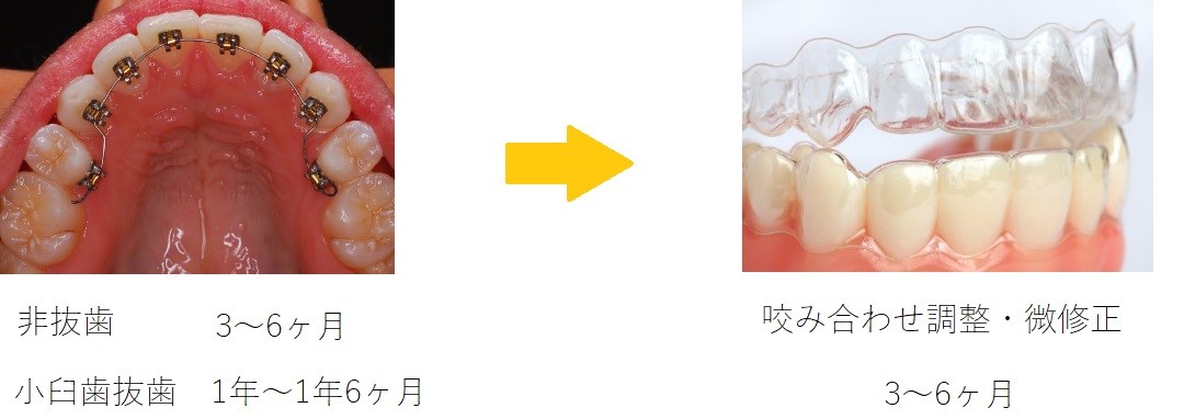 コラボ矯正治療期間と治療方法