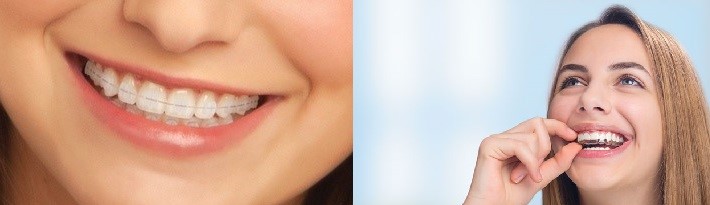 表側矯正&マウスピース矯正イメージ