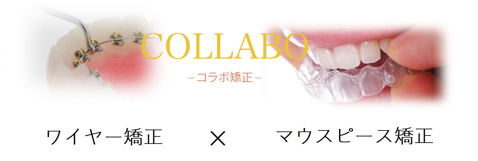 コラボ矯正