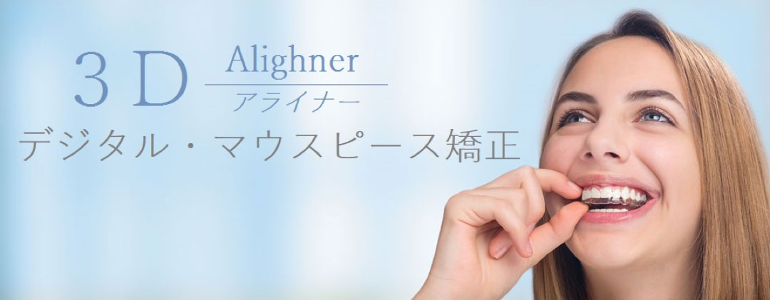 3Dデジタル・マウスピース部分矯正