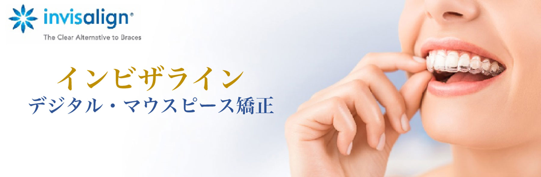 インビザライン デジタル・マウスピース矯正